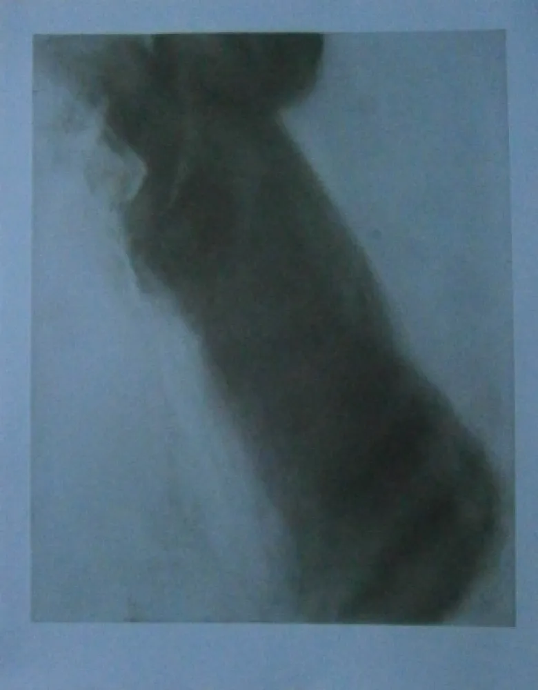 Água-Forte Garache - Bleue