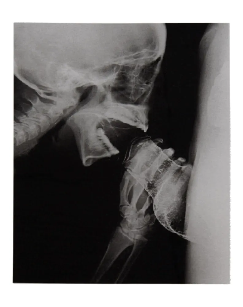 Livro Ilustrado Delvoye - Sexrays