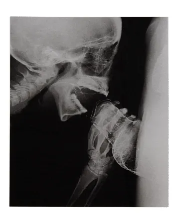 Livro Ilustrado Delvoye - Sexrays