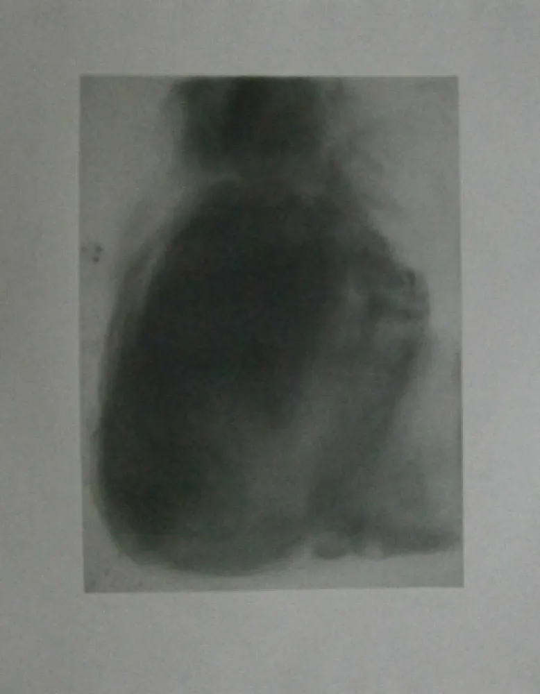 Água-Forte Garache - Tourette