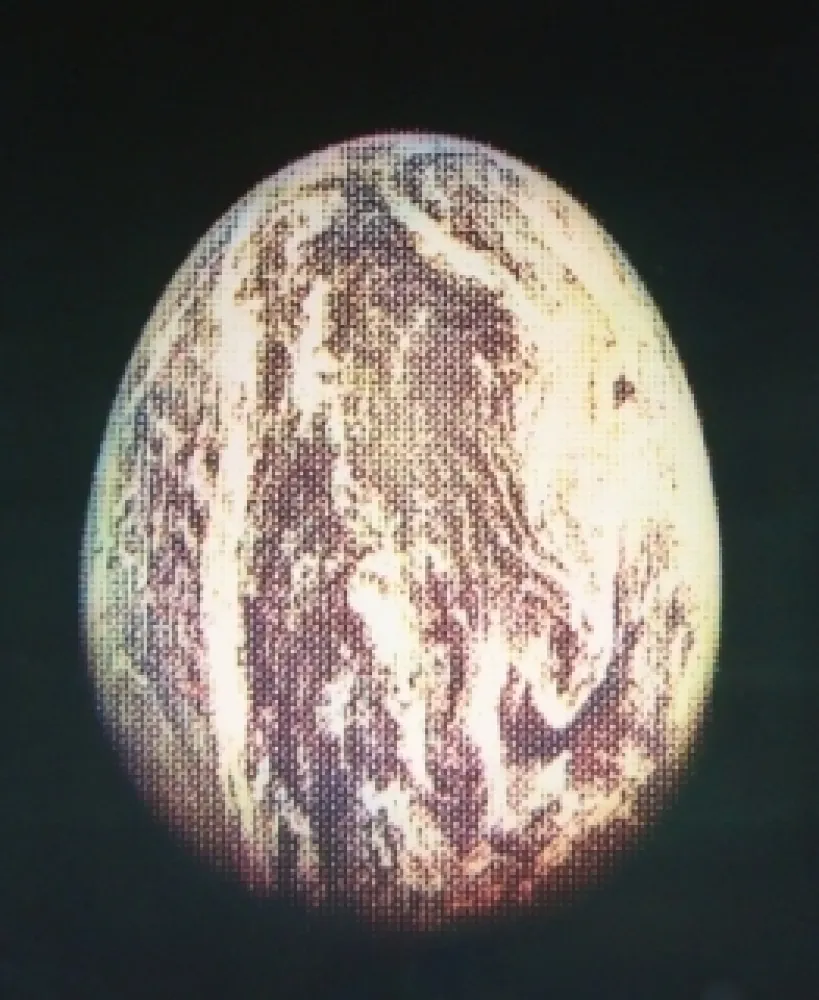 Água-Forte E Água-Tinta Jacquet - L'oeuf